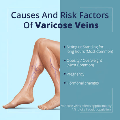ODEIUN™ Natural Relief Cream for Varicose Veins